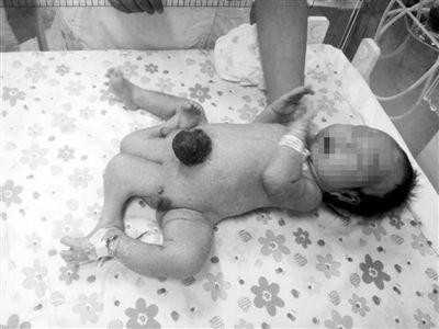 苏州供卵代怀_三代试管婴儿步骤过程详细是怎样的？