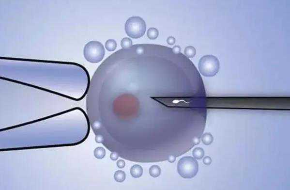 多囊肾三代试管_二代试管培养失败_泰国试管婴儿移植进行胚胎冷冻的原因？