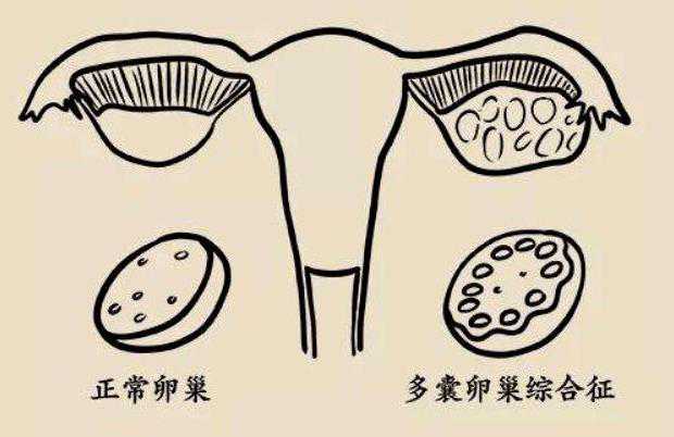 广州供卵试管婴儿最好医院_生殖中心供卵试管多少钱_第三代试管取了25个卵子